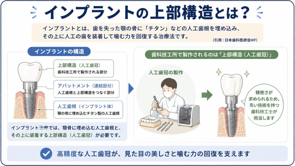 インプラント上部構造の役割を示した図解