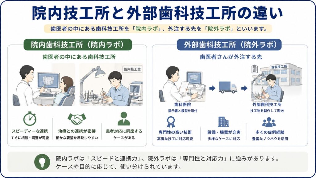 院内歯科技工所と外部歯科技工所の違いを示した図解